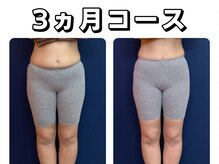 久留米スポーツ整骨院 整体院/エステ◆痩身インディバエステ