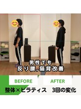 そらまめ接骨院/スカイビーンズ(SkyBeans)/反り腰、評価