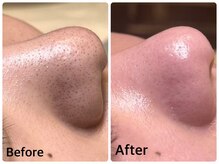 クロス(Xcross)の雰囲気（《毛穴エクストラクション認定サロン》毛穴悩みをスッキリ解消！）