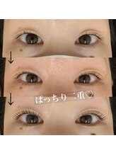 マージ イマージュ/ライバルは美容外科！！