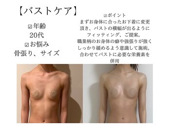 サロンツキ(salon tuki)/バストケア症例