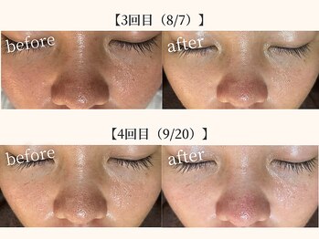 ドリームスパ 町田店(DREAM SPA)/before→after