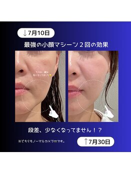 リオル(Rior)/2025年最強の小顔ケア