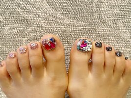 埋め込みフットネイル