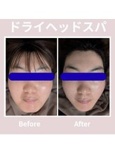 ミヨン ヨコハマ(Miyonne Yokohama)/美容師監修☆極上小顔ヘッドスパ