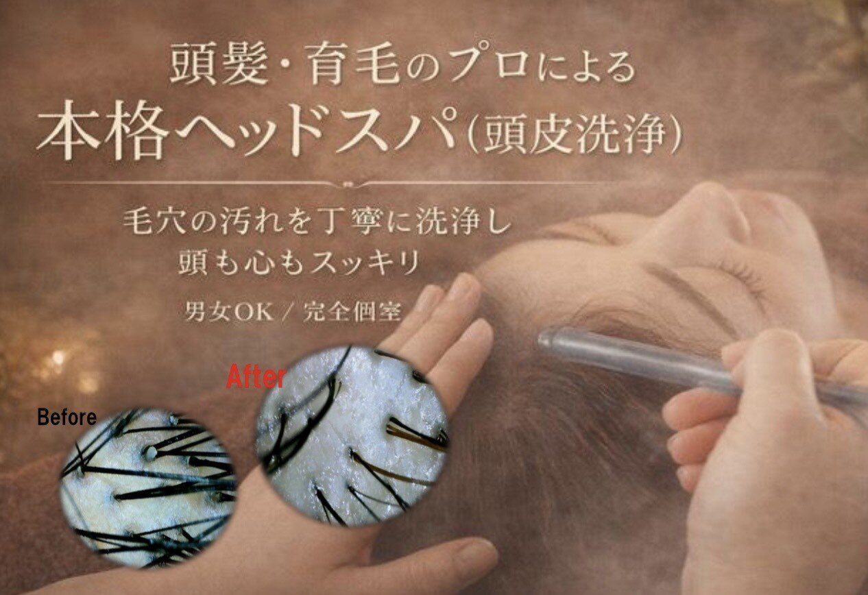 スーパースカルプ 大津店(SuperScalp)｜ホットペッパービューティー