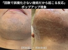 ダイヤ 名古屋中川区店(Daiya)の雰囲気（Daiya式脱毛設計は、毎回実感と変化を重ねる脱毛。最短で完了へ）