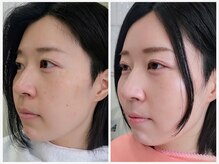 エタニティ(Eternity)/メイクlesson