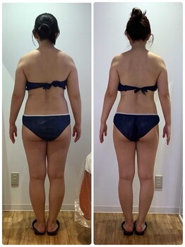 ルミナ ビューティーアンドリラックス(LUMINA Beauty&Relax)の写真/《効果を実感》高性能マシン×熟練スタッフのプロの技で理想のボディラインへ導きます♪