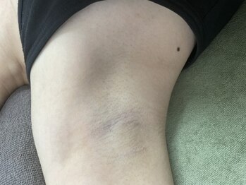 ナノハナ/鹿沼市全身脱毛美容室ナノハナ