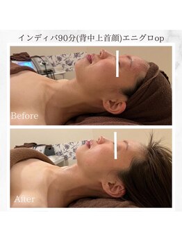 ルピナス(Lupinus)/顔の色味が一発で激変!!