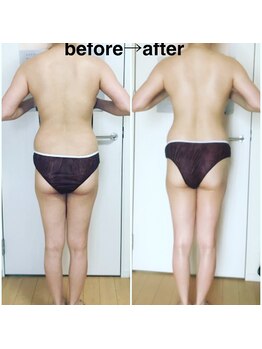 ハーティ(hati)/技術力の高さをご体感下さい！