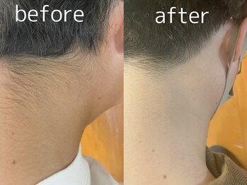 セカンドフロア バイ ブレスト ハコダテ(2nd floor by BLESSED HKD)/垢抜けするなら全身脱毛♪