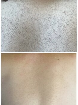 ソワイユ 浜松店(Soyeux)/ワックス脱毛(Waxxxx)