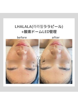 ポムハヌル(pom.haneul)/韓国肌管理室