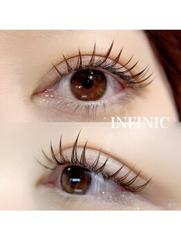 アンフィニック バイ ミソノ(INFINIC by misono)/持続力抜群LED施術