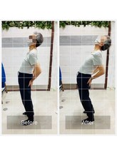 門前仲町イエティ鍼灸整骨院（旧：イエティ鍼灸整骨院）/ビィフォーアフター♪