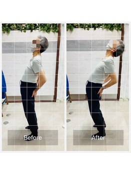 門前仲町イエティ鍼灸整骨院（旧：イエティ鍼灸整骨院）/ビィフォーアフター♪