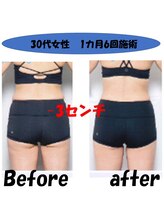 フェリス.ディア(Feliz.Dia)/【ビフォーアフター2】