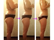 バービーホリック(barbie holic)/痩身　途中経過の変化　３０代