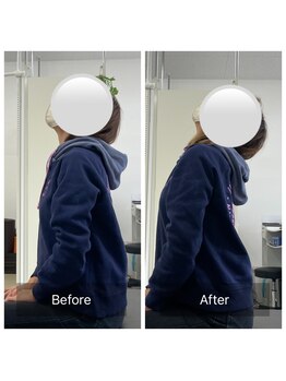 ナオル整体 大里院(NAORU整体)/50代女性 下を向くのが辛い