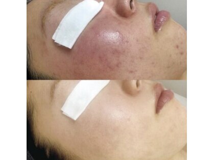 フロムミー 銀座本店(FROM ME)の写真