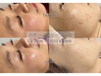 サロン エム(saron M)