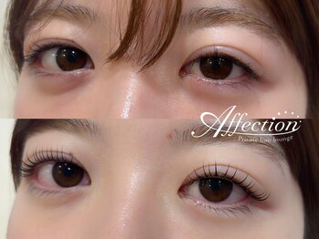 アフェクション アイビューティー(Affection eye beauty)/まつげパーマ