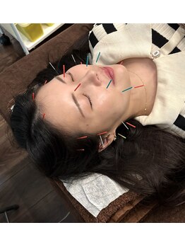 小林整骨院 本町/全身調整美容鍼