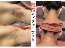 ビモア(Bmore)の雰囲気（★爆抜けで大好評LED脱毛★最速卒業でリーズナブル！）