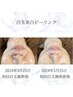 【理想の韓国ツヤ肌に!】高濃度AHA20%配合!水光キメ肌作ります!