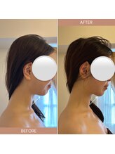 心奏(cocokana)/月に1回×6ヶ月での変化