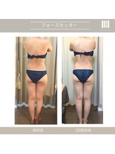 カリスボーテ 関本店/フォースカッター