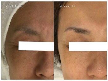 シアン(CYAN)/before/after 乾燥ぐすみ