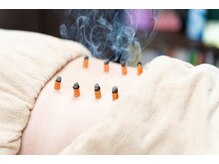 リンク 広島中区(Link)/施術風景