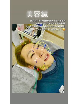 ハリーズエヌ(harry's N)/美容鍼のメンズお客様4