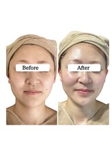 ル ボヌール/シミケア&エクソソームハーブ