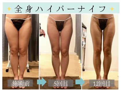 スリムプロ 天王寺店(Slimpro)の写真