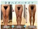 スリムプロ 天王寺店(Slimpro)の写真