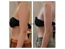 エステサロン カラーズ(COLORS)の雰囲気(20代女性/ブライダル痩身6回/BeforeAfter写真)