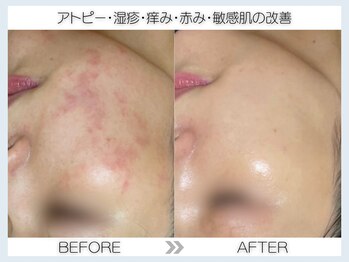 フェアリー(fairy)/