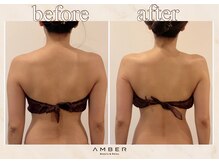 アンバー 恵比寿(AMBER)/美背中、ブライダル♪