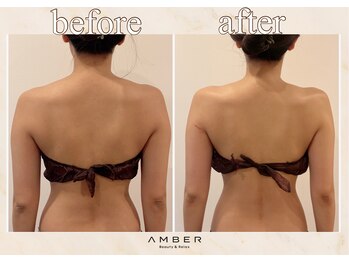 アンバー 恵比寿(AMBER)/美背中、ブライダル♪