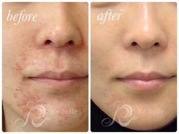 チップ(chip)/ここまで変わる