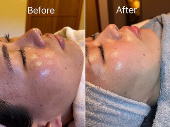 アリス(Alice)/マツヤニWAX Before/After