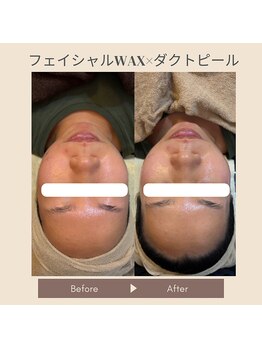 ギンザ リボーン(Ginza Reborn)の写真/【ハリツヤUPで水光肌へ♪】お悩みを徹底改善☆お肌の内側から潤いを与えて憧れのツヤツヤ肌になれる◎