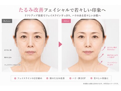 ラヴィブルー(raviblue)の写真