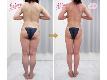 アンジェ あゆむ鍼灸院/人気NO.1 Ange式メディセル施術