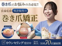 巻き爪補正店　天神店【巻き爪・分厚い爪・魚の目・角質】【10/1 OPEN（予定）】の雰囲気（医師監修の巻き爪補正店。痛みが少ない・切らない巻き爪ケア）