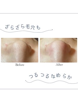 ハーバルミヨン(Herbal Miyong)/アクアピールでつるつる